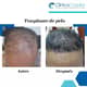 Slider image (9) Clinica Capilar